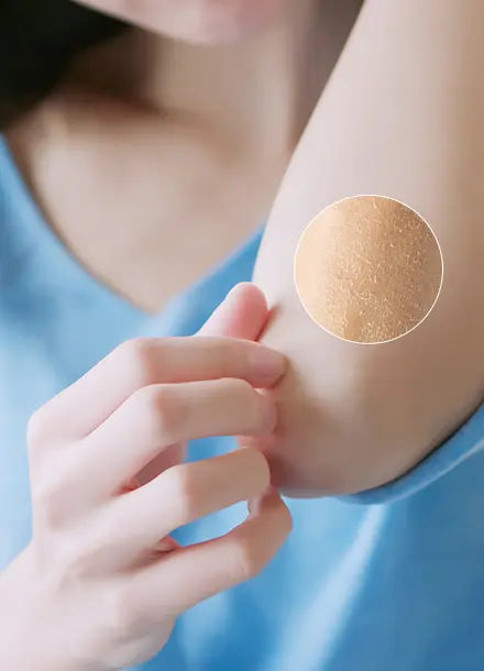 Dermafique Intensive Restore Body Serum: The Ultimate Barrier Repair Serum